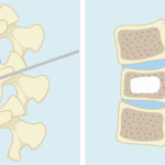高雄長庚肺臟移植重生奇蹟 點亮南台灣 助病人重生不遠行
