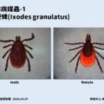 全球萊姆病病例攀升　台灣現首例境外移入